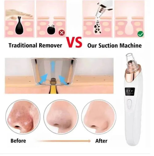 5 in 1 Electric Rechargeable Black Head Remover Machine